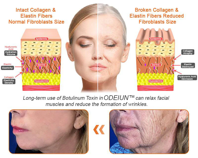 Made and Shipped from USA ✨ ODEIUN™ Bee venom Comprehensive Cream 🔥 LAST DAY 80% OFF 💎💎 - Image 9