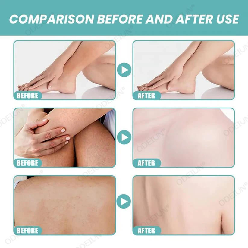 đ Indulge in Pure Luxury - 49% OFF - ⨠Ultra-Hydrating Bath & Shower Oil - For Silky Smooth Skin - Image 4