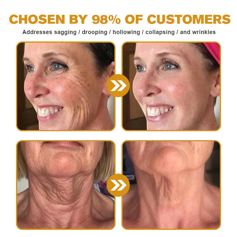 đFlash Sale - ODEIUN⢠BOTOX Bee Venom Anti-Aging Serum - Suitable for all skin typesđđ - Image 13