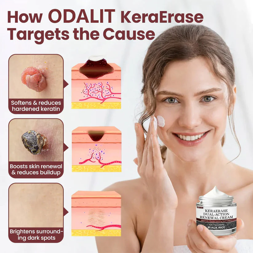 ✅Flash Sale - ODALIT®KeraErase Dual-Action Renewal Cream - Image 2