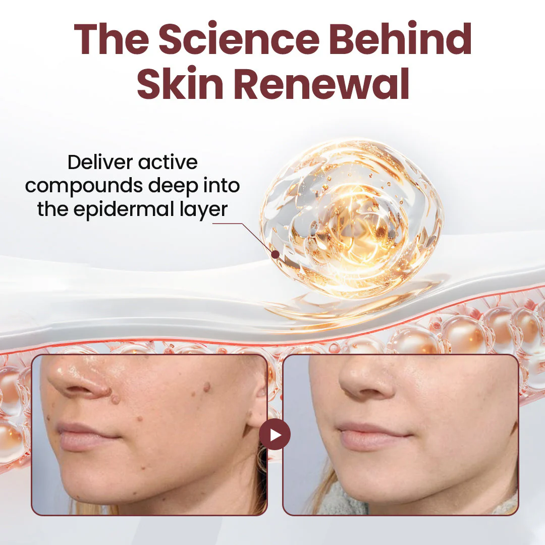 ✅Flash Sale - ODALIT®KeraErase Dual-Action Renewal Cream - Image 4