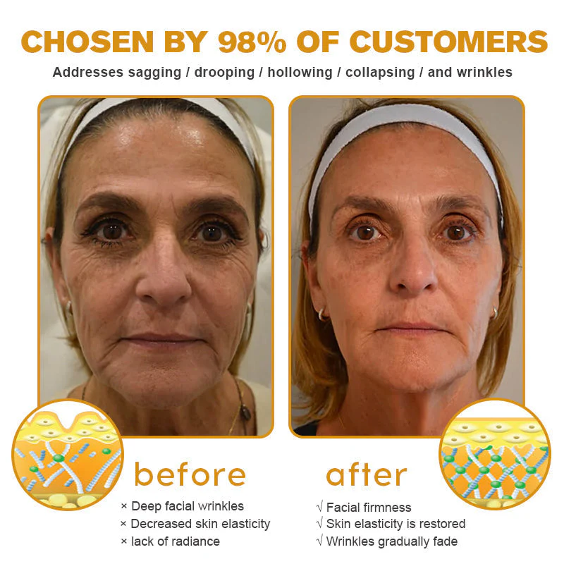 (Made and Shipped from USA) 🧑⚕️ODALIT™ Botox Bee Venom Wrinkle Removal Cream- LAST DAY 70% OFF🔥 - Image 8