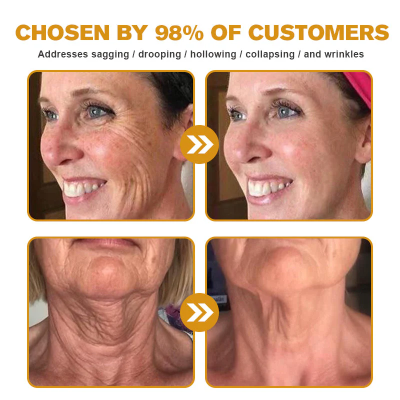 (Made and Shipped from USA) 🧑⚕️ODALIT™ Botox Bee Venom Wrinkle Removal Cream- LAST DAY 70% OFF🔥 - Image 9