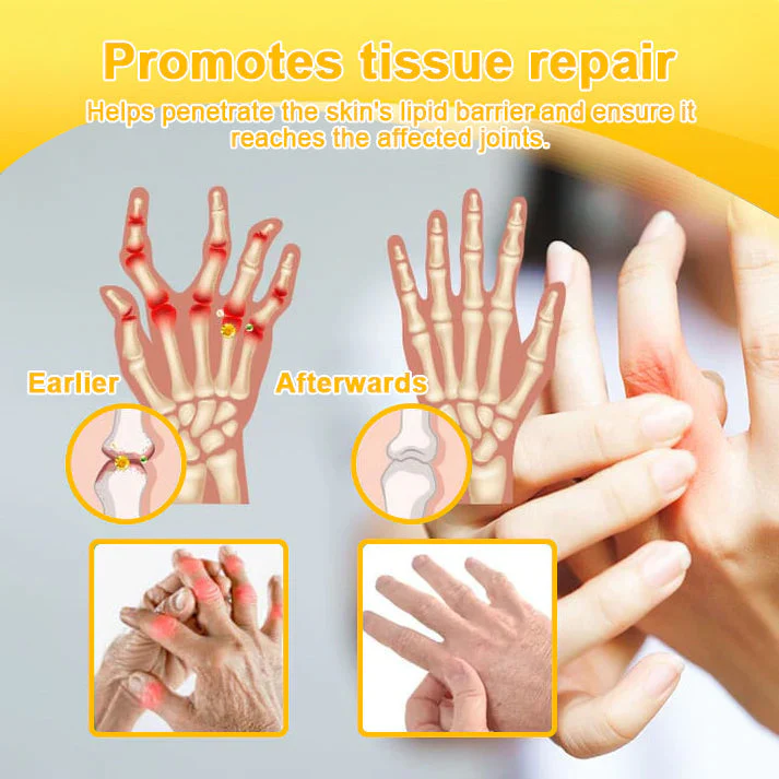đFlash Sale - ODALIT⢠Botulinum Toxin & Bee Venom Pain-Relief Bone Healing Creamđđ - Image 4