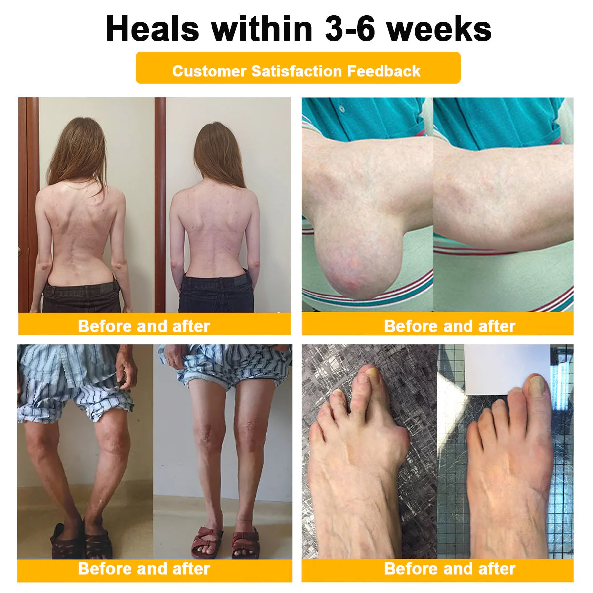 đFlash Sale - ODALIT⢠Botulinum Toxin & Bee Venom Pain-Relief Bone Healing Creamđđ - Image 6