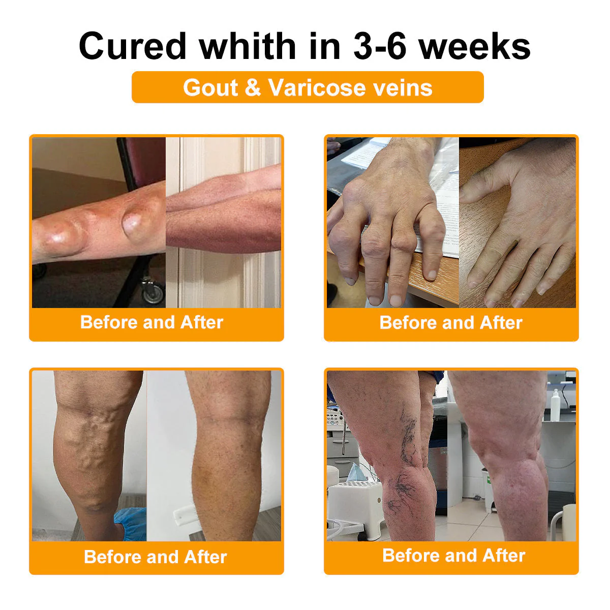 đFlash Sale - ODALIT⢠Botulinum Toxin & Bee Venom Pain-Relief Bone Healing Creamđđ - Image 8