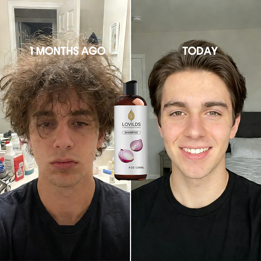 🌱 Regrow Your Hair Naturally —Onion Repair & Growth Shampoo - Image 2