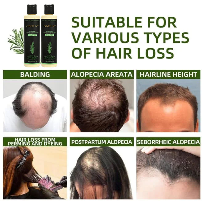 🌱 Organic Rosemary Hair Growth Shampoo - Image 7