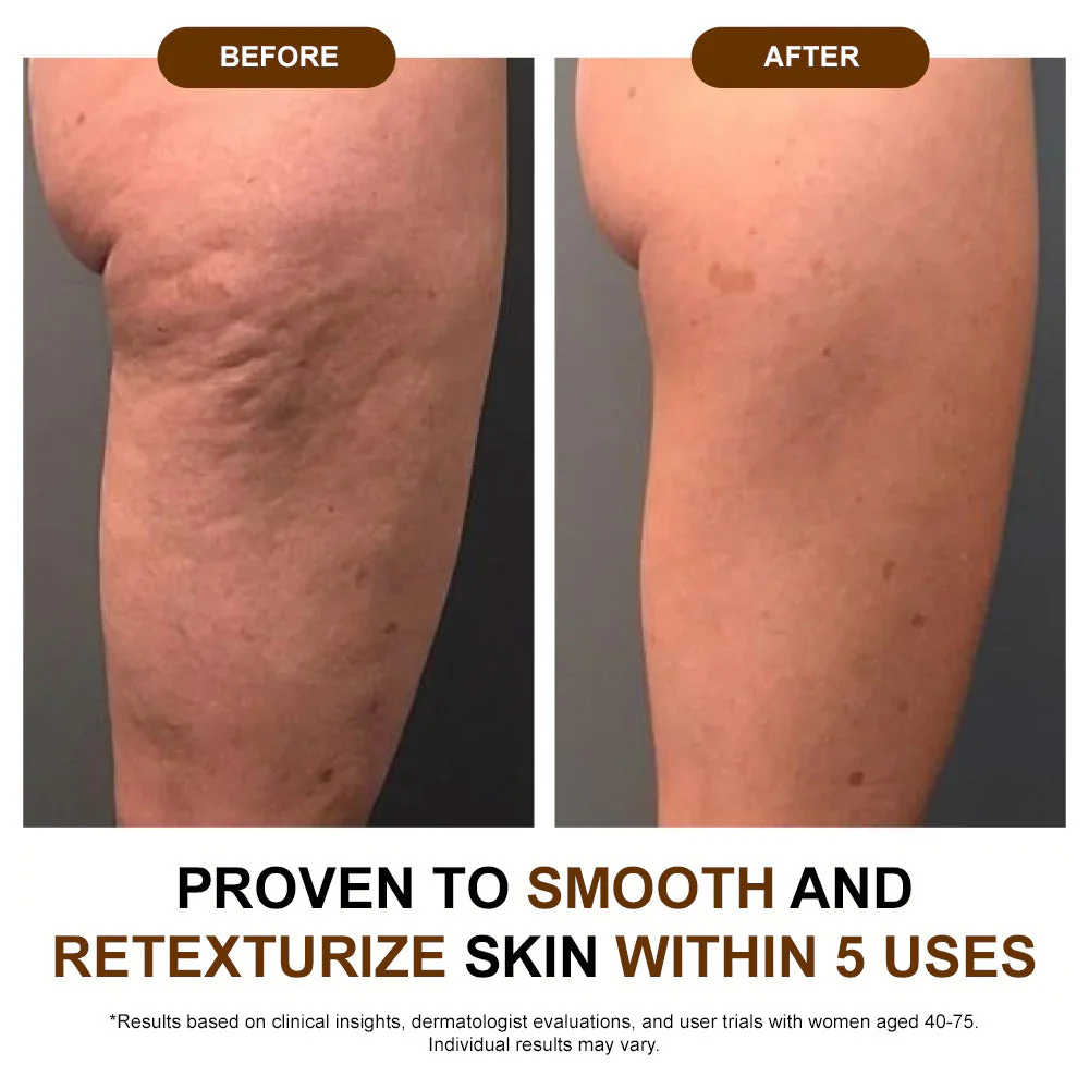 ✅ODEIUN® 𝐒𝐢𝐥𝐤 𝐁𝐨𝐝𝐲 𝐎𝐢𝐥 ✨ Firms, Lifts & Smooths the Skin, Reduces Wrinkles, and Restores Youthful Elasticity - Image 6